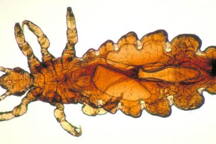Pest Control - Croach - Kirkland, WA - Female Head Lice