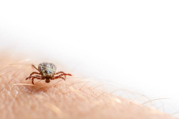 Tick Crawling on Human Arm - Tick Bite - Croach Pest Control 600x400